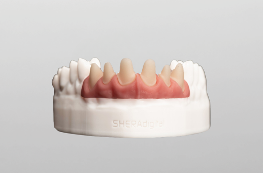 3D Modell mit herausnehmbaren Stümpfen