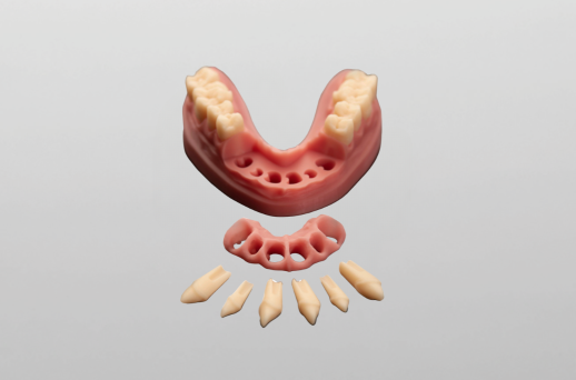 3DModell mit herausnehmbaren Stümpfen und Zahnfleisch