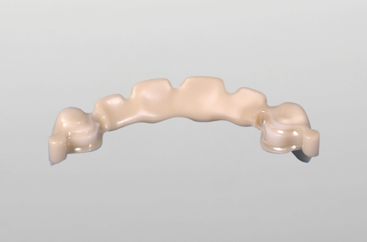 Geschiebearbeit in Zirkon